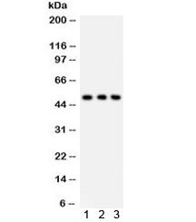 Western blot testing of 1) human PANC, 2) A549 and 3) HT1080 lysate with SLC2A2 antibody. Expected m