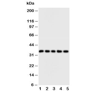 Western blot testing of FosB antibody and Lane 1: HT1080; 2: SW620; 3: HeLa; 4: SMMC-7721; 5: MM453