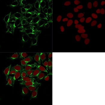 Clathrin Heavy Chain Antibody