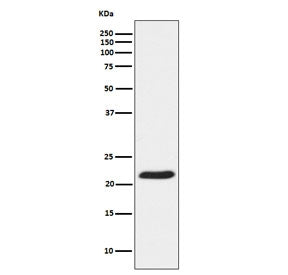 TCTP Antibody / TPT1