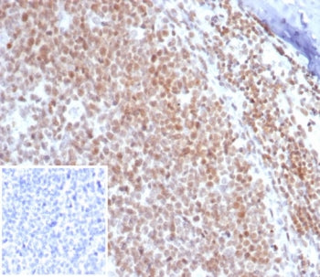IHC staining of FFPE human tonsil tissue with c-Myc antibody (clone MYC/7854R). Inset: PBS used in p