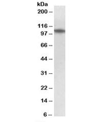 Western blot testing of human thymus lysate with TXNDC11 antibody at 1ug/ml. Predicted molecular wei