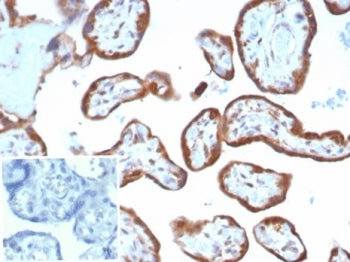 VEGF Antibody / Vascular Endothelial Growth Factor