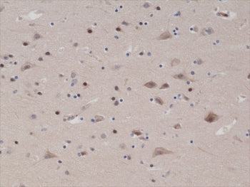 PTEN Antibody