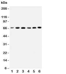 Western blot testing of CETP antbody on human cell lysates 1: HeLa; 2: COLO320; 3: HT1080; 4: Jurkat; 5: Raji; 6: MCF-7 cell lysate. Expected molecular weight: 66~74 kDa depending on glycosylation level.