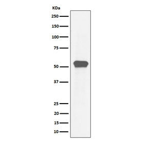 Western blot testing of human HeLa cell lysate with Myocyte enhancer factor 2A antibody. Predicted m