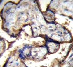 Integrin alpha 5 antibody immunohistochemistry analysis in formalin fixed and paraffin embedded huma