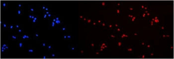 HNRNPA2B1 Antibody
