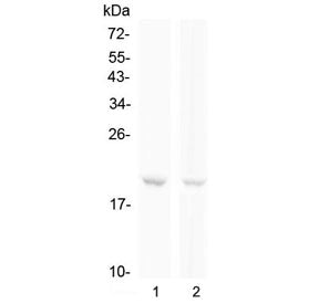 BCMA Antibody / CD269 / TNFRSF17