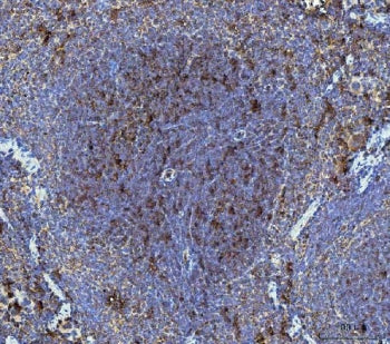 IHC staining of FFPE mouse spleen tissue with Dickkopf-1 antibody. HIER: boil tissue sections in pH8