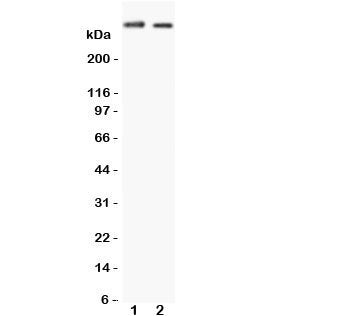 Western blot testing of Huntingtin antibody and Lane 1: human HeLa cell lysate and 2: human U-87 MG