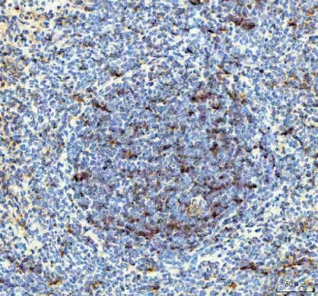 IL-18 Antibody