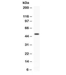 Western blot testing of human A549 cell lysate with FCGRT antibody. Expected/observed molecular weig