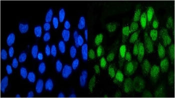 DDR1 Antibody