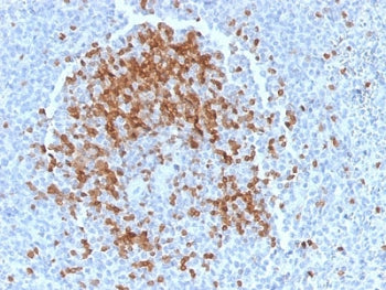 TCL1 Antibody
