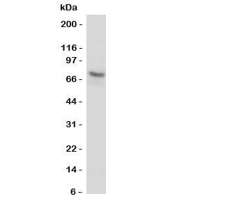Western blot testing of P2X7 antibody and human U87-MG cell lysate. Expected molecular weight: 65~85