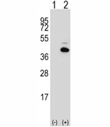 PITX1 Antibody