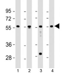 EFS Antibody / Embryonal Fyn-associated substrate