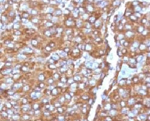 Chromogranin A Antibody