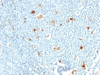 S100A9 Antibody / MRP14 / Calgranulin B / Calprotectin L1H
