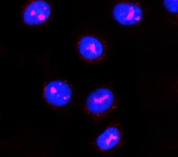 PPAN Antibody / Suppressor of SWI4 1 homolog