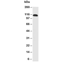 CEACAM5 Antibody