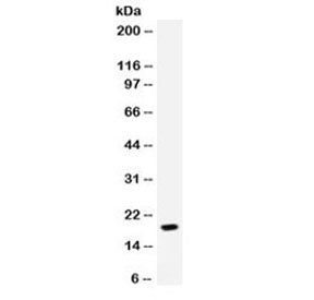 NAP-2 Antibody / CXCL7