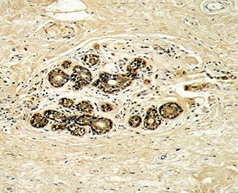 HER3 Antibody (ERBB3)