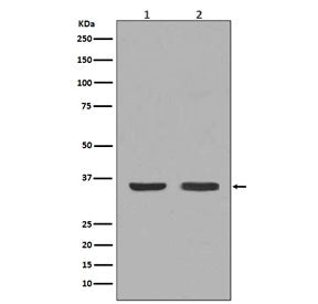NGF Antibody / Beta Nerve Growth Factor