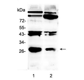Western blot testing of 1) rat brain and 2) mouse brain with PDGF beta antibody at 0.5ug/ml. Predict