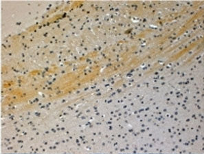JIP3 Antibody