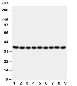 Western blot testing of Kallikrein 10 antibody and lysate from 1: rat ovary; 2: rat testis; 3: rat s