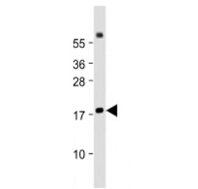 Chemerin / RARRES2 Antibody (Center Region)