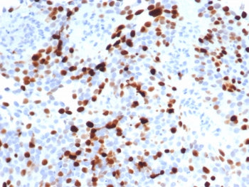Topoisomerase II alpha Antibody / TOP2A
