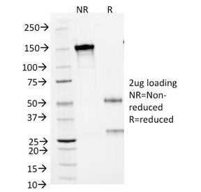 SCLC Marker Antibody