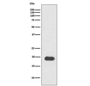 Myosin Light Chain 2 Antibody / MLC2 / MYL2
