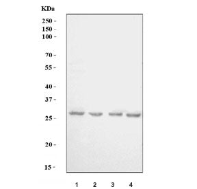 UCP3 Antibody / SLC25A9