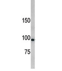 LLGL1 Antibody