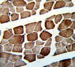 ATP5O Antibody