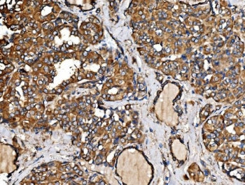 IRBIT Antibody / AHCYL1