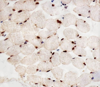 IHC testing of FFPE human skeletal muscle tissue with PPARA antibody. HIER: steam section in pH6 cit