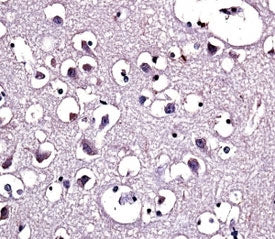 LPL antibody immunohistochemistry analysis in formalin fixed and paraffin embedded human brain tissu