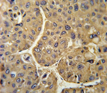 FHR-5 Antibody / Complement factor H-related protein 5 / CFHR5