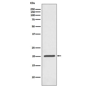 FTH1 Antibody / Ferritin heavy chain