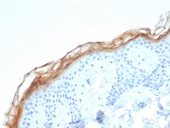 Kallikrein 7 Antibody / KLK7