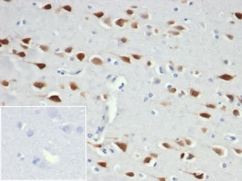 IHC staining of FFPE human brain tissue with recombinant NeuN antibody (clone NeuN/6694R). Negative