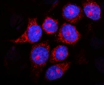 Presenilin 2 Antibody