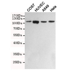 FAK Antibody / Focal Adhesion Kinase