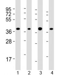 ARHGEF39 Antibody / C9orf100
