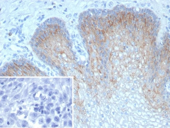 IHC staining of FFPE human esophagus tissue with recombinant TRIM29 antibody (clone TRIM29/9256R). I